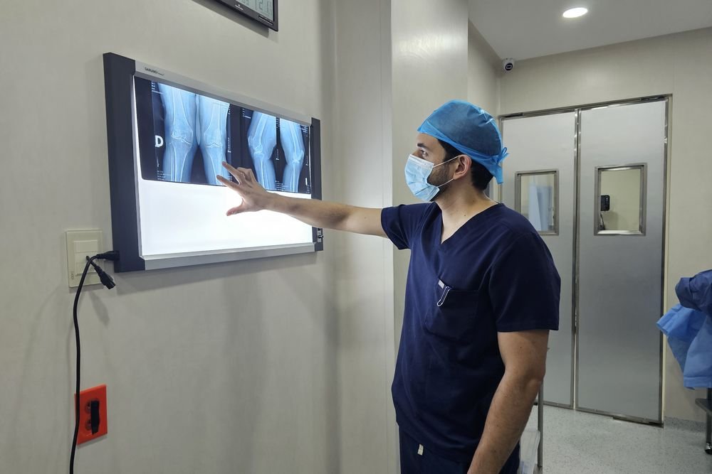 Dr. Córdova revisando radiografías de rodilla